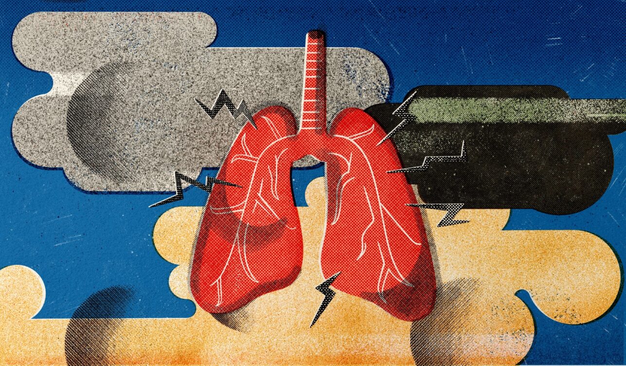 Промышленная пыль и заболевания лёгких