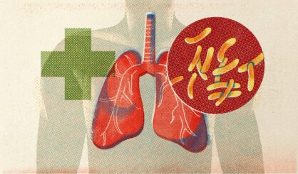 Как бороться с профессиональным туберкулёзом