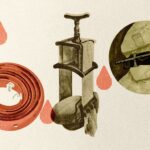 От бинта Эсмарха до турникета: краткая история жгута